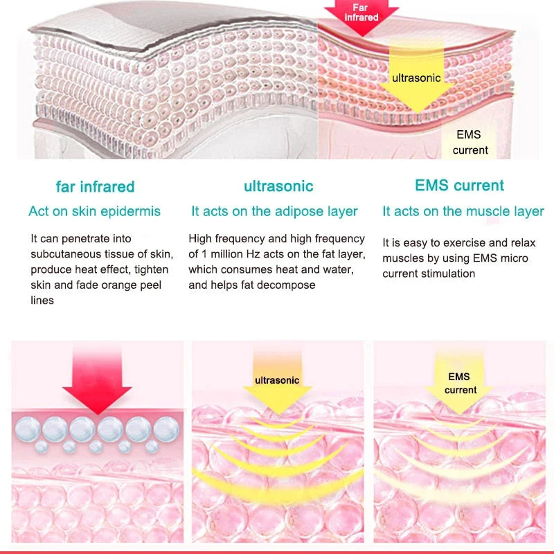 UltraTone 360 - Infrared Fat Burner & Cellulite Remover